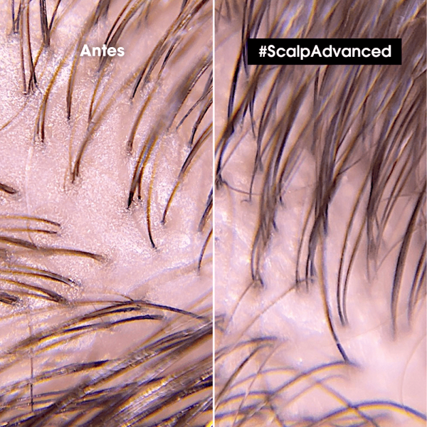 Arcilla Purificante Scalp Advanced 2 en 1 Anti Oleosidad - L'Oréal Professionel 250 ml - Imagen 4