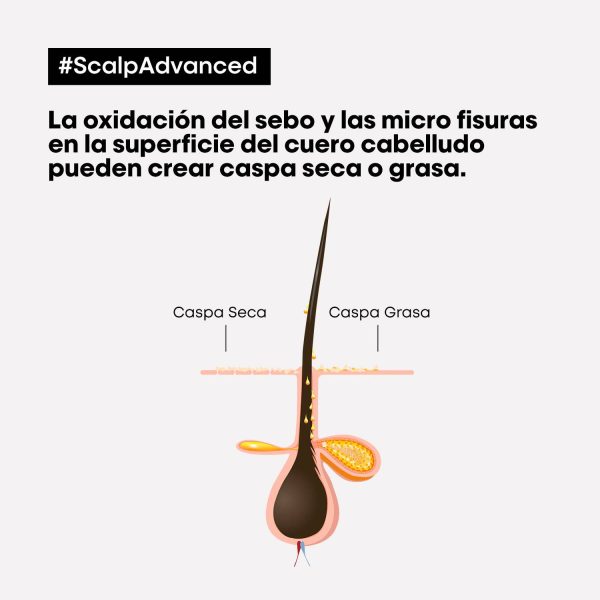 Shampoo Anti Caspa Scalp - L'Oréal Professionel 300 ml - Imagen 2