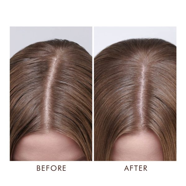 Tratamiento Cuero Cabelludo Seco Moroccanoil 45 ml - Imagen 4